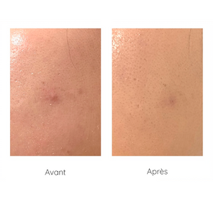 Trouble Carrot Magic Patch